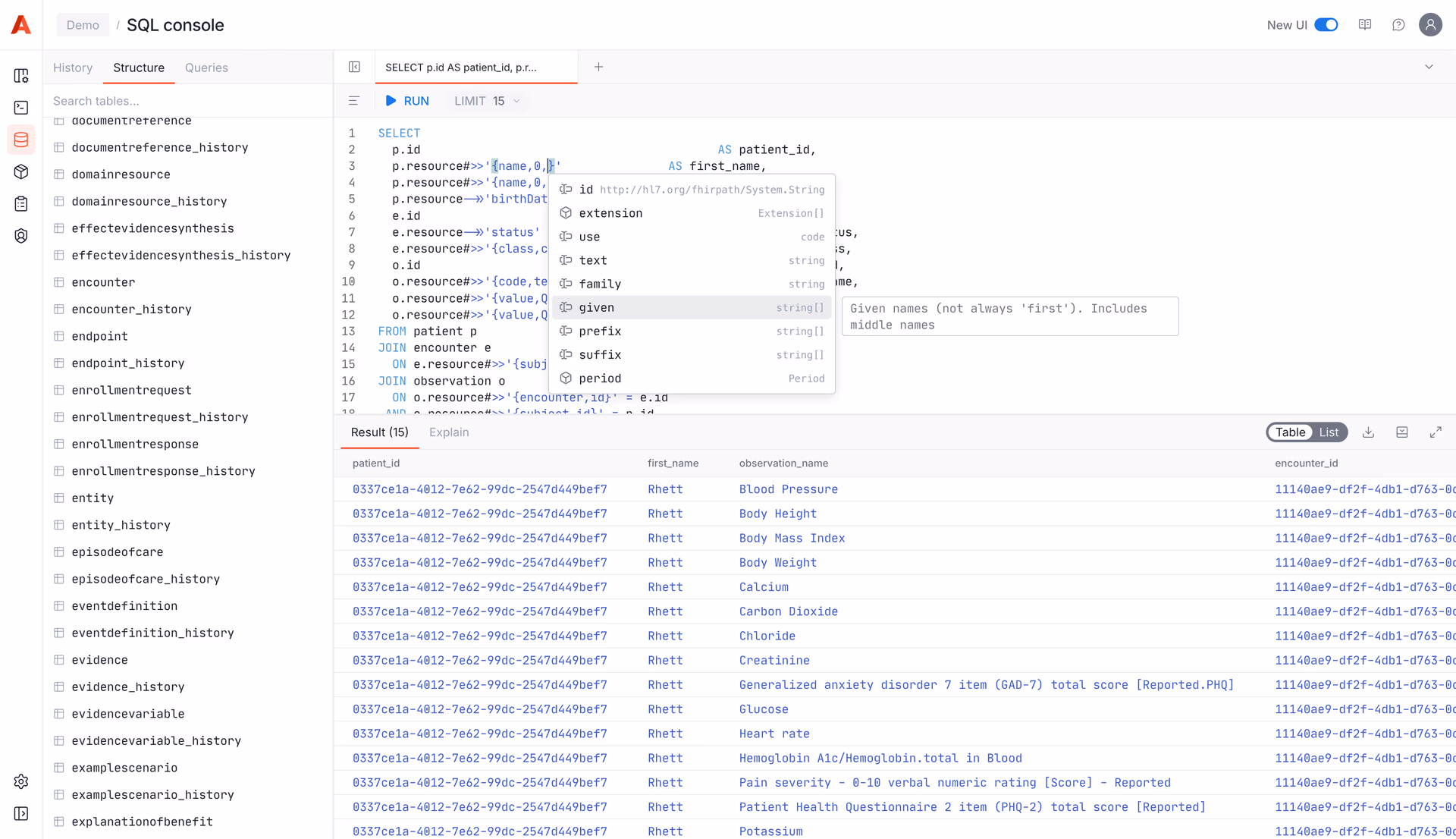 SQL Console